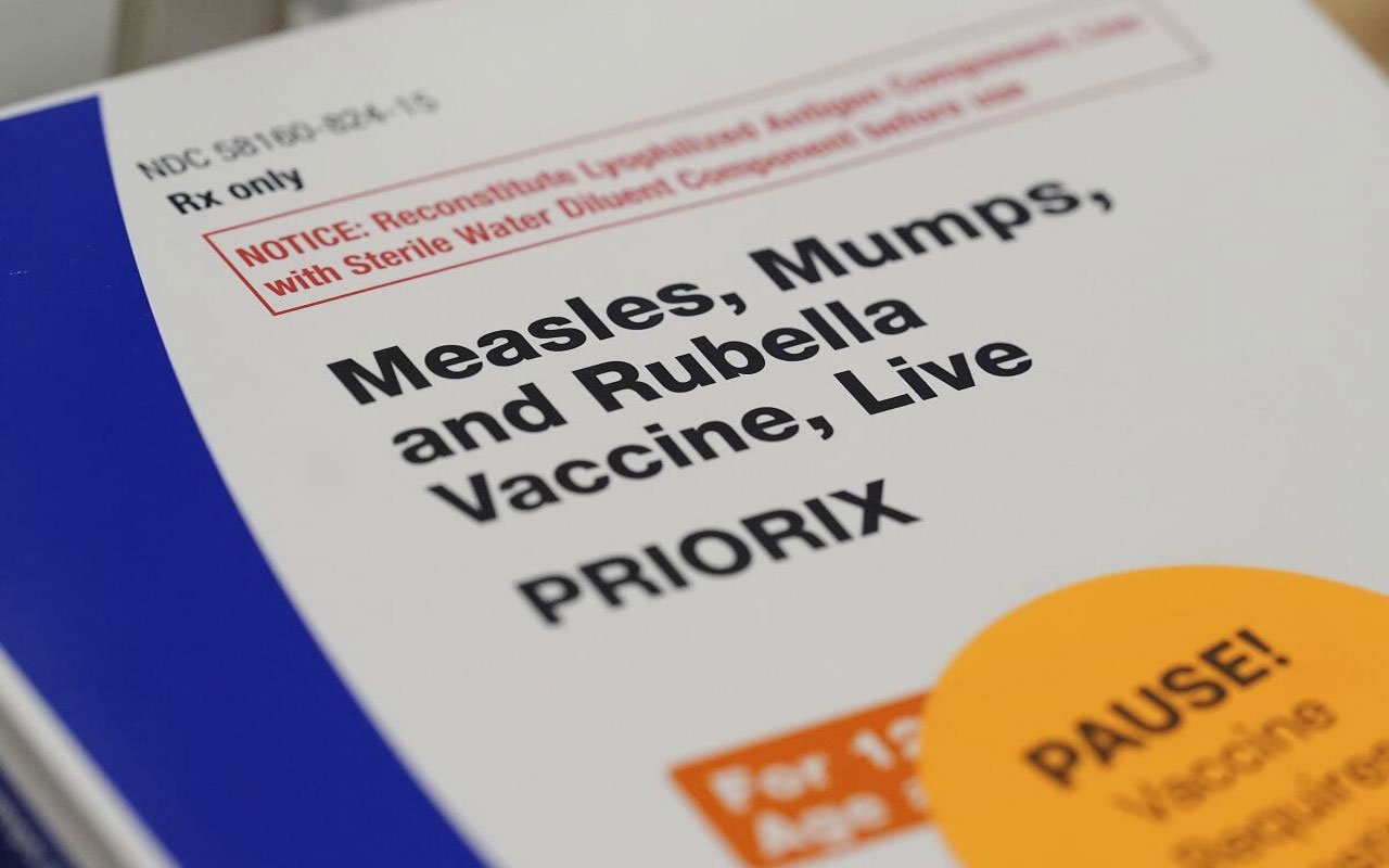 Los Angeles measles death